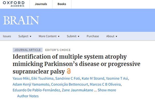 Leia mais sobre o artigo Identification of multiple system atrophy mimicking Parkinson’s disease or progressive supranuclear palsy